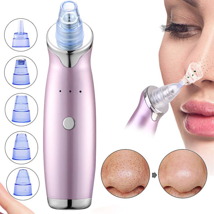 Blackhead Remover